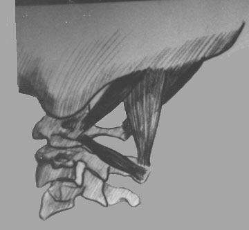 Lateral view of suboccipital muscles